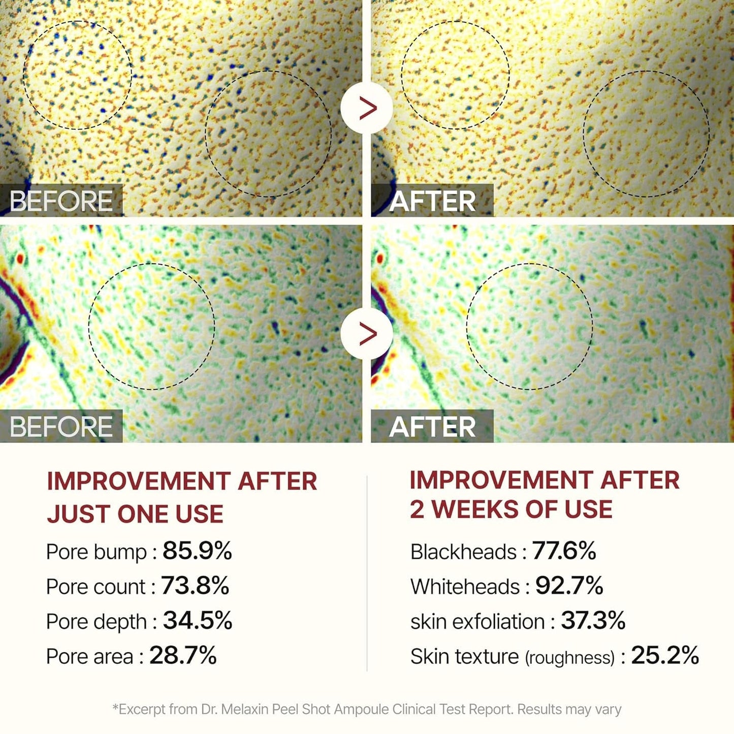 Dr.Melaxin Peel Shot Rice Exfoliating Ampoule 80ml